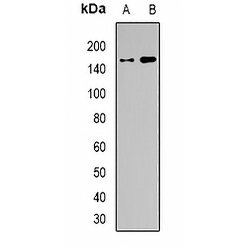 BAF155 Rabbit Polyclonal Antibody