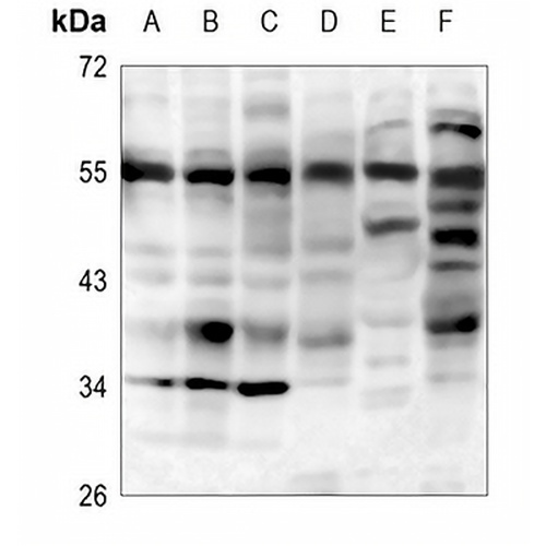 IRAK4 Rabbit Polyclonal Antibody