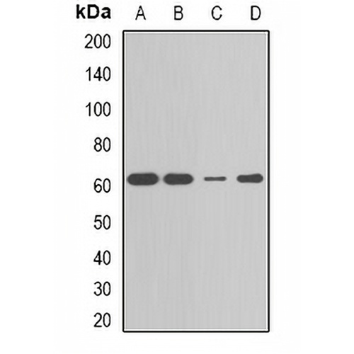 CBX4 Rabbit Polyclonal Antibody