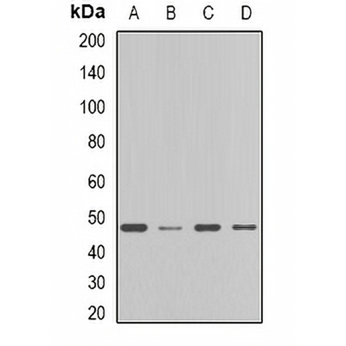 FDFT1 Rabbit Polyclonal Antibody