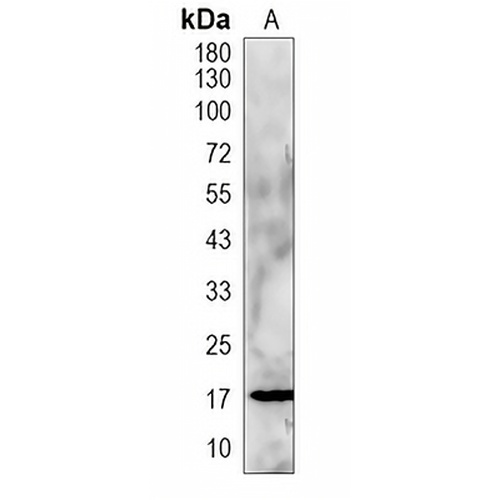 GIP Rabbit Polyclonal Antibody