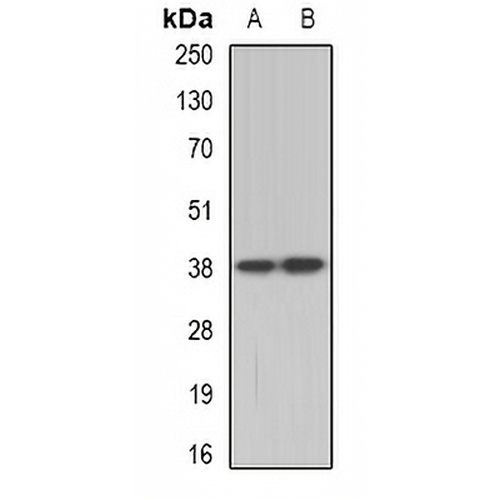 TEL2 Rabbit Polyclonal Antibody
