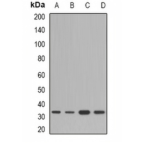 HSD17B13 Rabbit Polyclonal Antibody