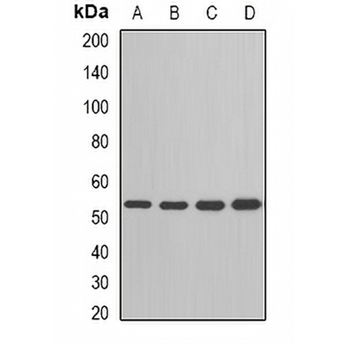 ADSL Rabbit Polyclonal Antibody