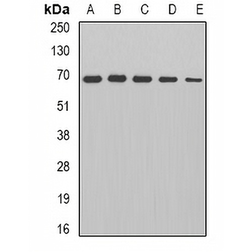 PDC-E2 Rabbit Polyclonal Antibody