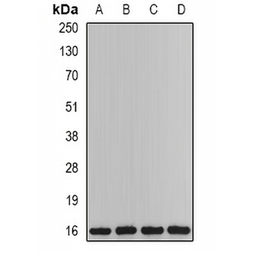 PTPS Rabbit Polyclonal Antibody