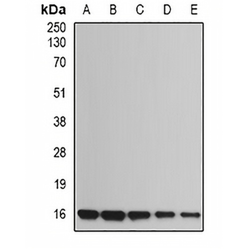 UBE2B Rabbit Polyclonal Antibody
