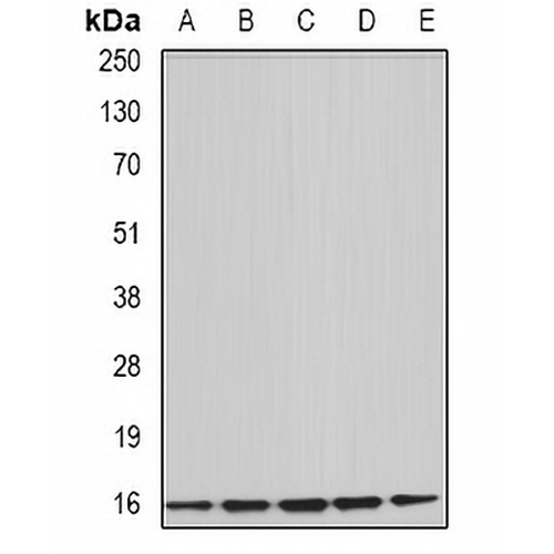 Uev1A Rabbit Polyclonal Antibody