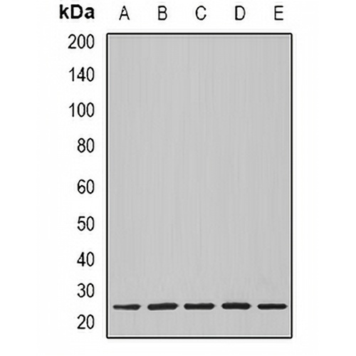 Nop30 Rabbit Polyclonal Antibody