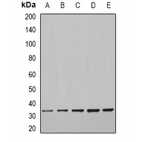 CFDP1 Rabbit Polyclonal Antibody
