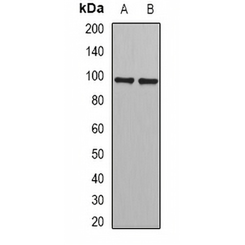 PHF17 Rabbit Polyclonal Antibody