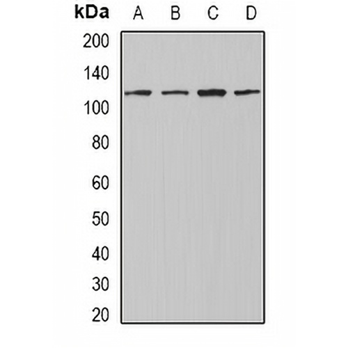 INTS4 Rabbit Polyclonal Antibody