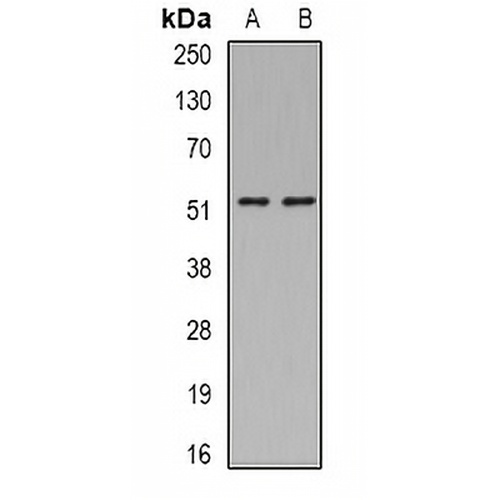 ASL Rabbit Polyclonal Antibody