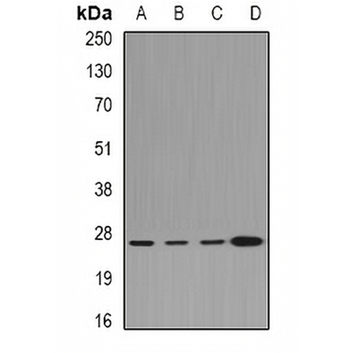 CLIC1 Rabbit Polyclonal Antibody