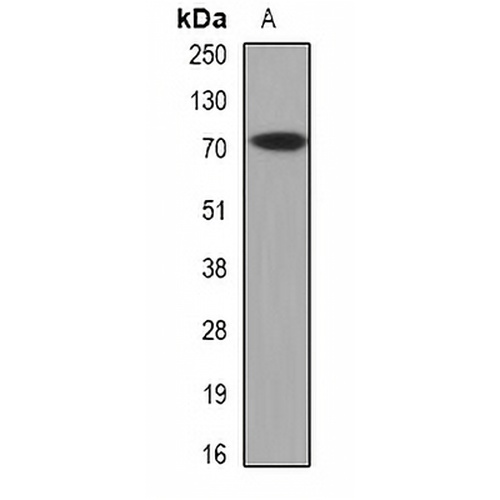 CAT1 Rabbit Polyclonal Antibody