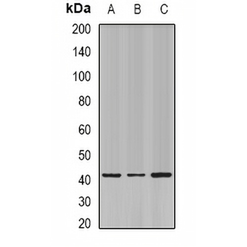 ESE-1 Rabbit Polyclonal Antibody