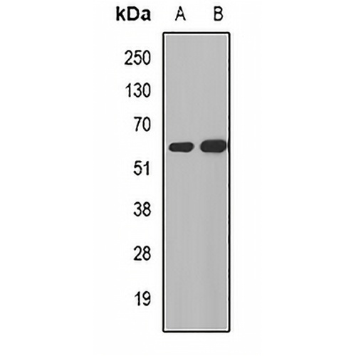 MGAT1 Rabbit Polyclonal Antibody