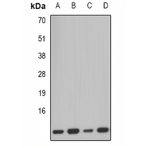 PCBD1 Rabbit Polyclonal Antibody