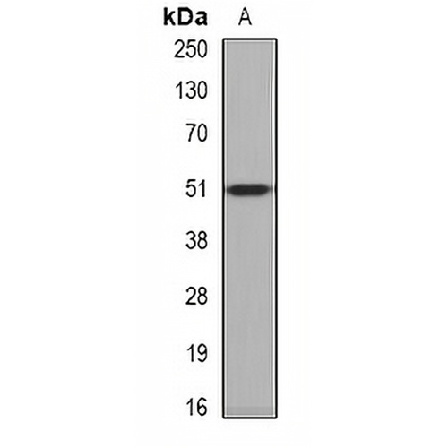 PPOX Rabbit Polyclonal Antibody