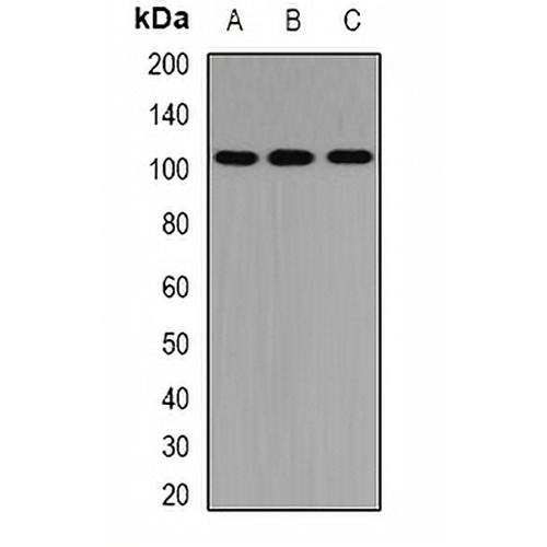 PTP-H1 Rabbit Polyclonal Antibody