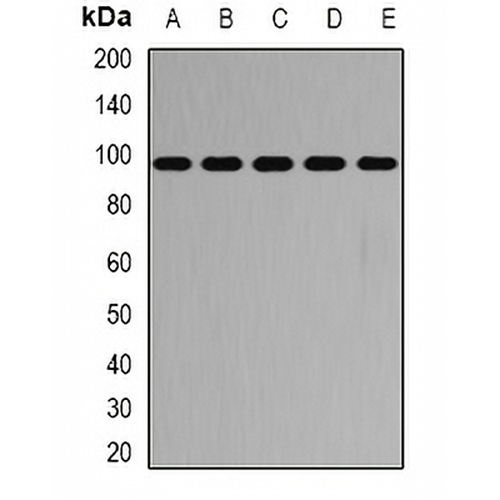 PYGB Rabbit Polyclonal Antibody