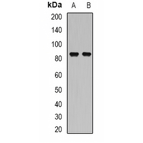 SSRP1 Rabbit Polyclonal Antibody
