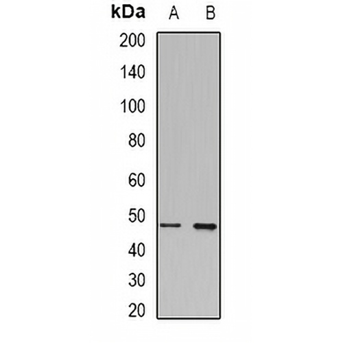 Transcobalamin-1 Rabbit Polyclonal Antibody