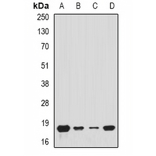 Tim17 Rabbit Polyclonal Antibody