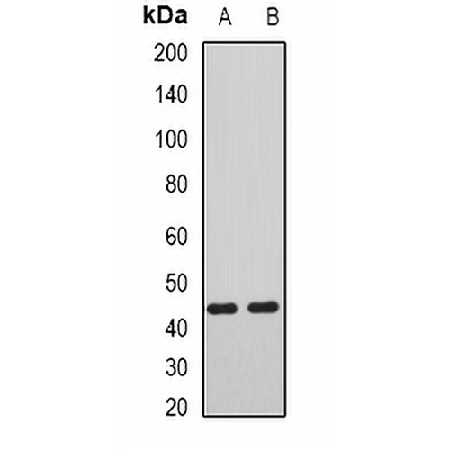AIPL1 Rabbit Polyclonal Antibody