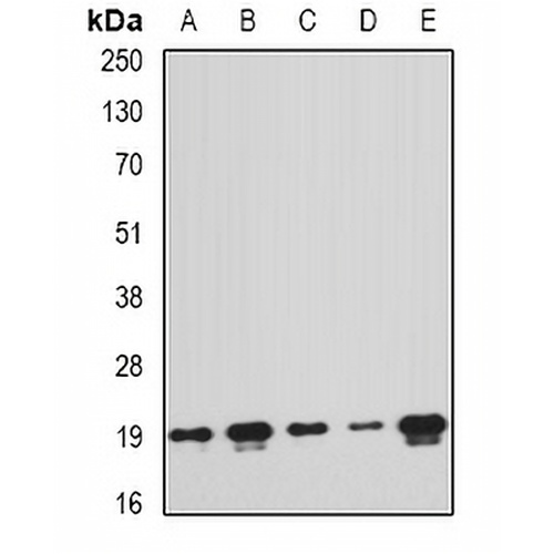 PTRH2 Rabbit Polyclonal Antibody