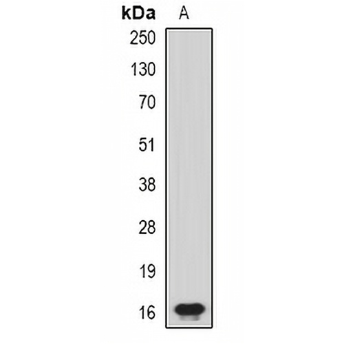 CHRAC17 Rabbit Polyclonal Antibody