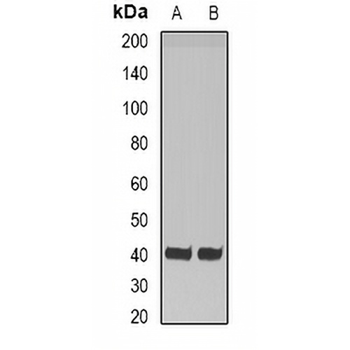 HAO1 Rabbit Polyclonal Antibody