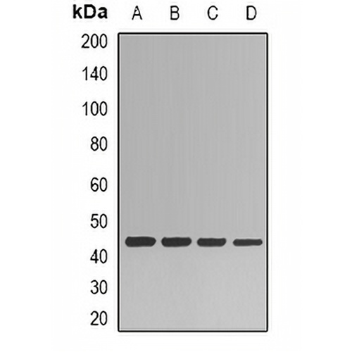 HPPDase Rabbit Polyclonal Antibody