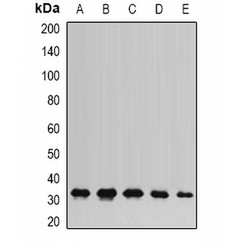 AK2 Rabbit Polyclonal Antibody