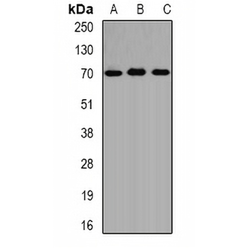 ALAS-H Rabbit Polyclonal Antibody