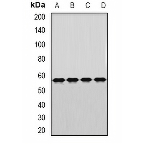 DARS Rabbit Polyclonal Antibody