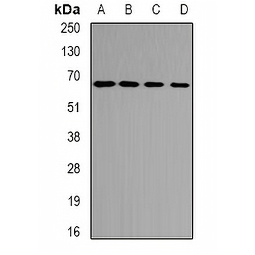 ETFDH Rabbit Polyclonal Antibody