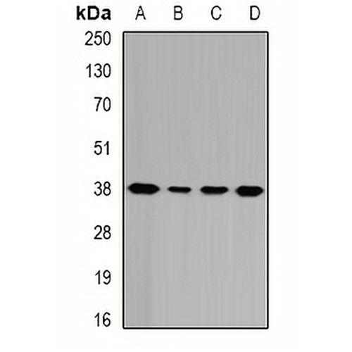 GALE Rabbit Polyclonal Antibody