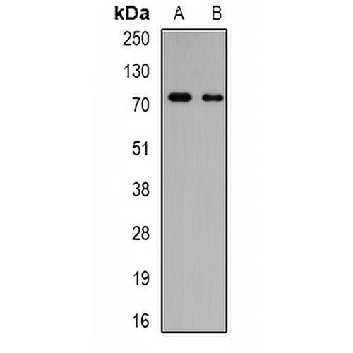 GalNAc-T3 Rabbit Polyclonal Antibody