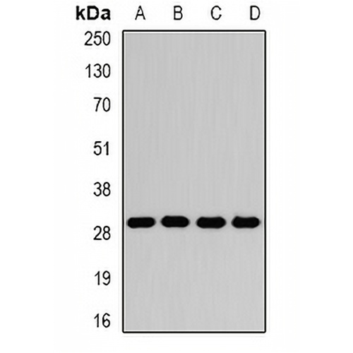 GAMT Rabbit Polyclonal Antibody