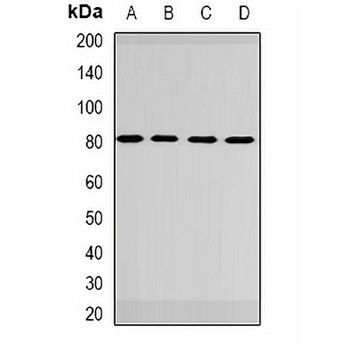 GBE1 Rabbit Polyclonal Antibody