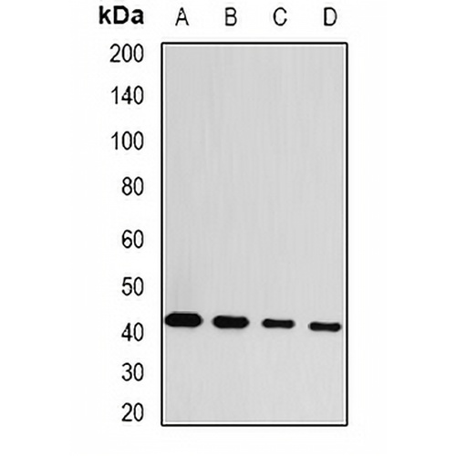 GDAP1 Rabbit Polyclonal Antibody