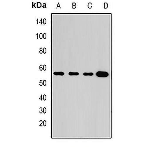 GLUD2 Rabbit Polyclonal Antibody