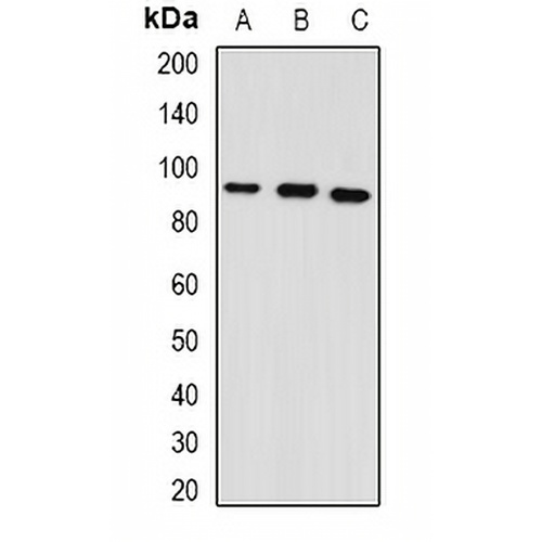 GPAM Rabbit Polyclonal Antibody