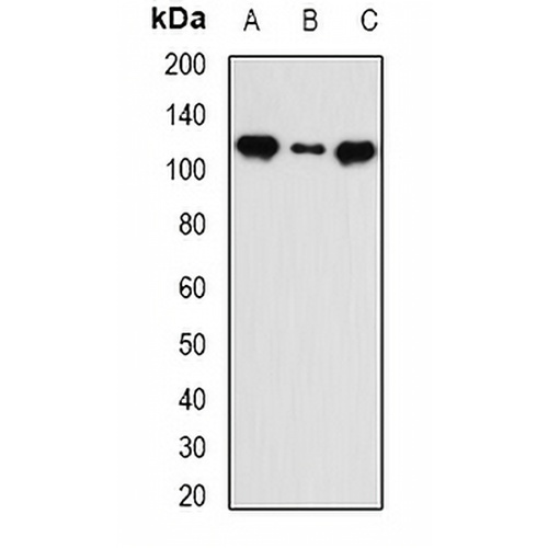 INTS5 Rabbit Polyclonal Antibody