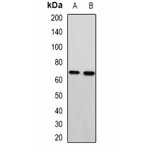 MTA3 Rabbit Polyclonal Antibody