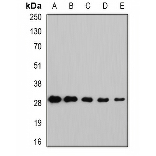 NNMT Rabbit Polyclonal Antibody