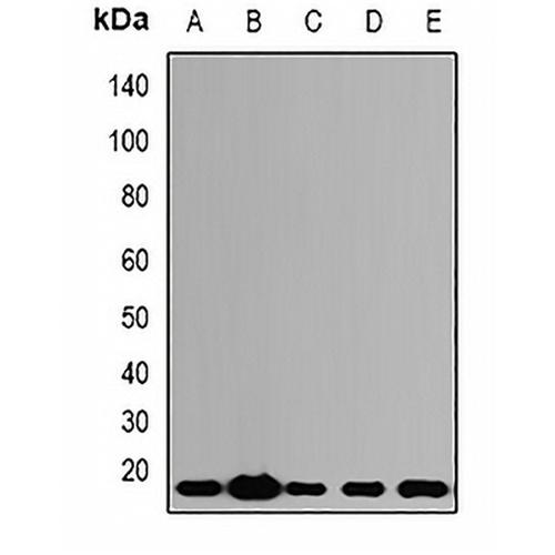 ALG-2 Rabbit Polyclonal Antibody