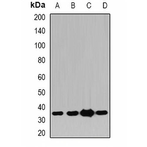 Pyridoxal Kinase Rabbit Polyclonal Antibody
