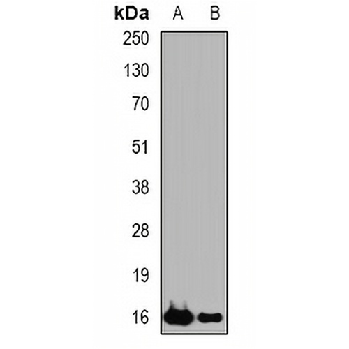 sPLA2-IID Rabbit Polyclonal Antibody